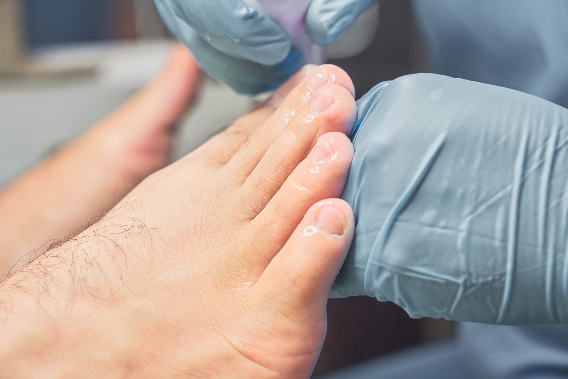 Podiatrist treating feet, concept chiropody